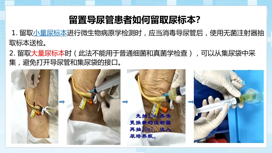导尿管相关尿路感染与防控_第15页