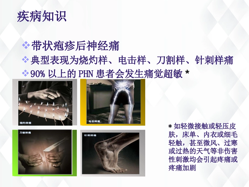 皮肤科-带状疱疹后遗神经痛护理查房_第9页