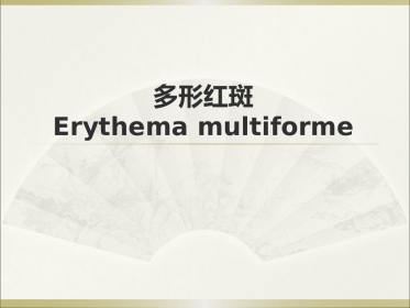 《皮肤病》多形红斑