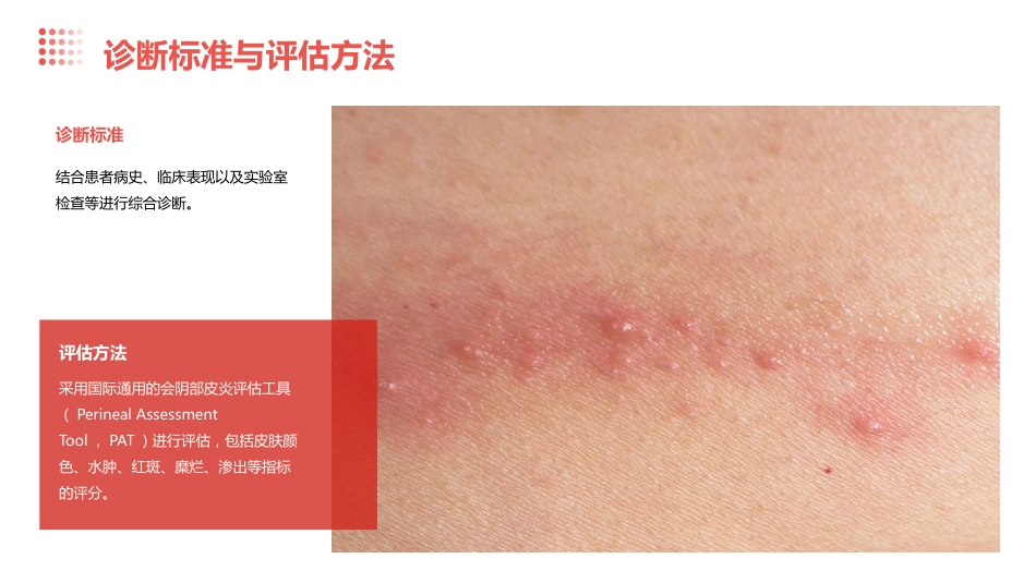 度失禁性皮炎预防及护理ppt课件_第6页