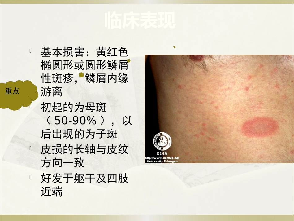 《皮肤病》玫瑰糠疹_第7页