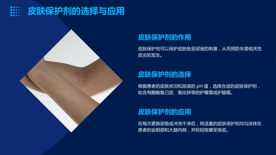 成人失禁相关性皮炎预防与护理ppt课件_第10页