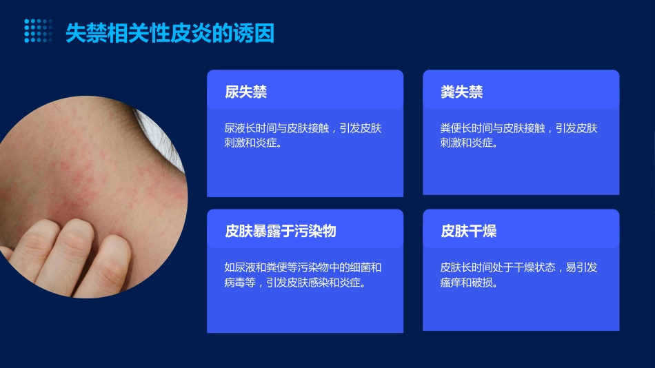 成人失禁相关性皮炎预防与护理ppt课件_第5页