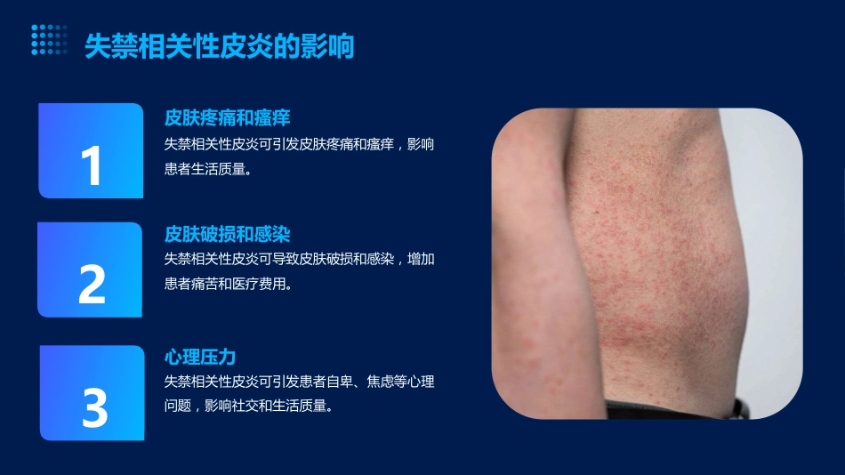 成人失禁相关性皮炎预防与护理ppt课件_第6页