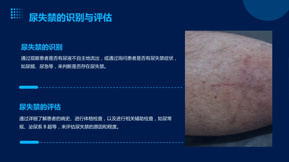 成人失禁相关性皮炎预防与护理ppt课件_第8页