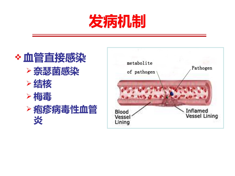 《系统性血管炎》_第14页
