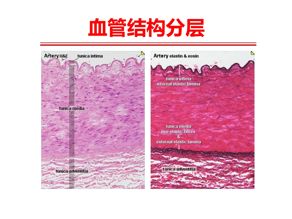 《系统性血管炎》_第3页