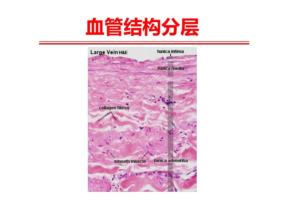 《系统性血管炎》_第4页