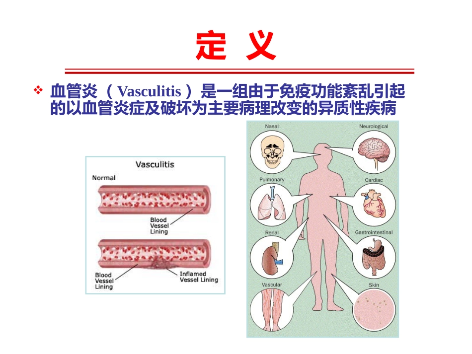 《系统性血管炎》_第6页