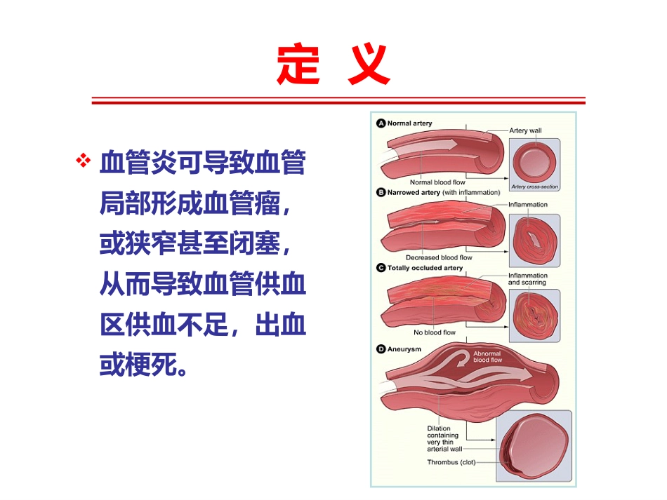 《系统性血管炎》_第7页