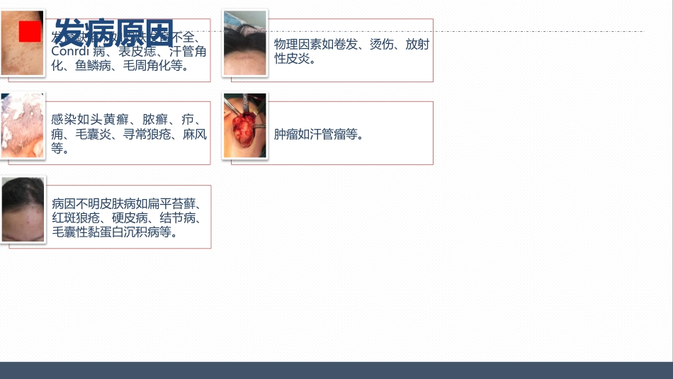 皮肤科-瘢痕性脱发患者的护理查房_第5页