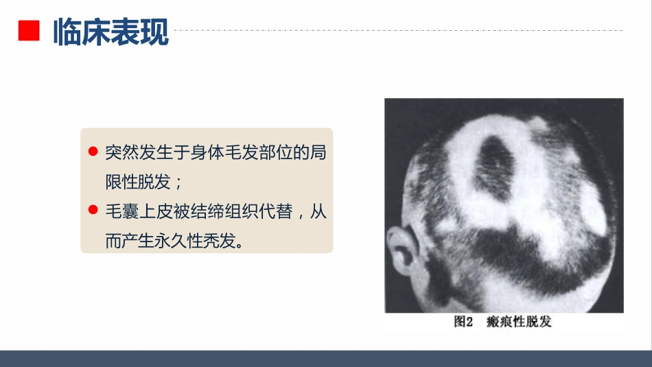 皮肤科-瘢痕性脱发患者的护理查房_第6页
