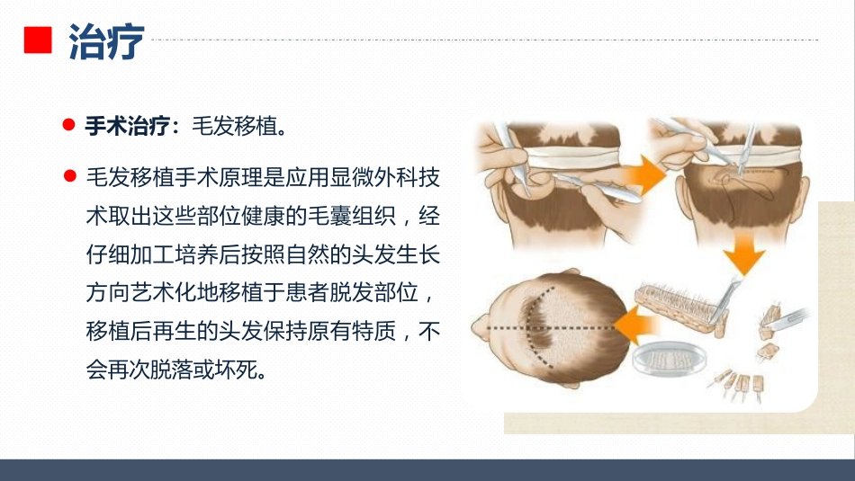 皮肤科-瘢痕性脱发患者的护理查房_第8页