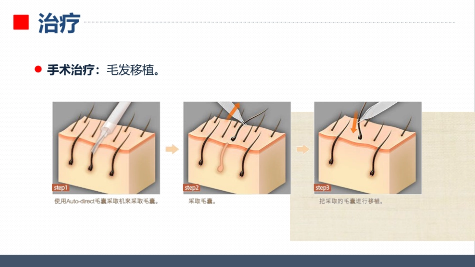 皮肤科-瘢痕性脱发患者的护理查房_第9页