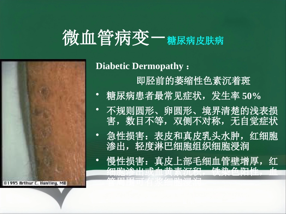 《糖尿病与皮肤病》PPT课件_第13页