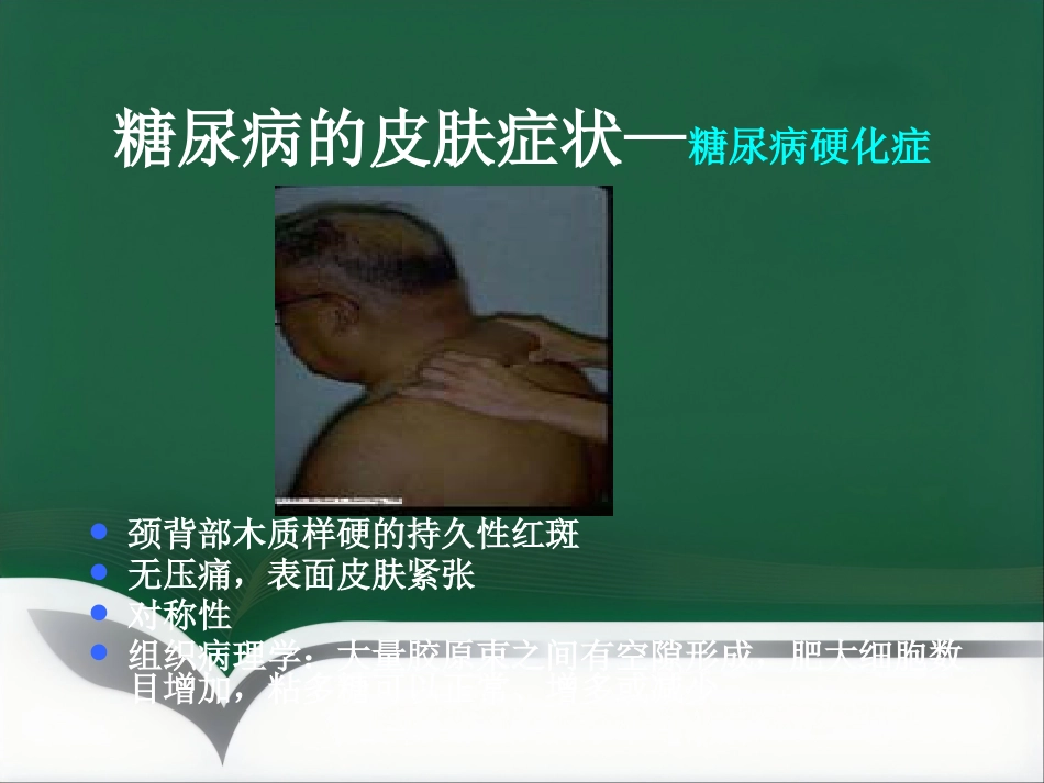 《糖尿病与皮肤病》PPT课件_第6页