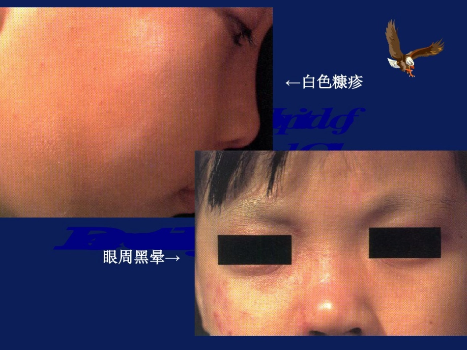 特应性皮炎AD的中西医诊疗进展_第9页
