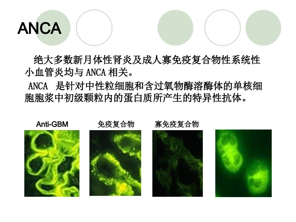 ANCA相关性血管炎医学知识讲解_第11页