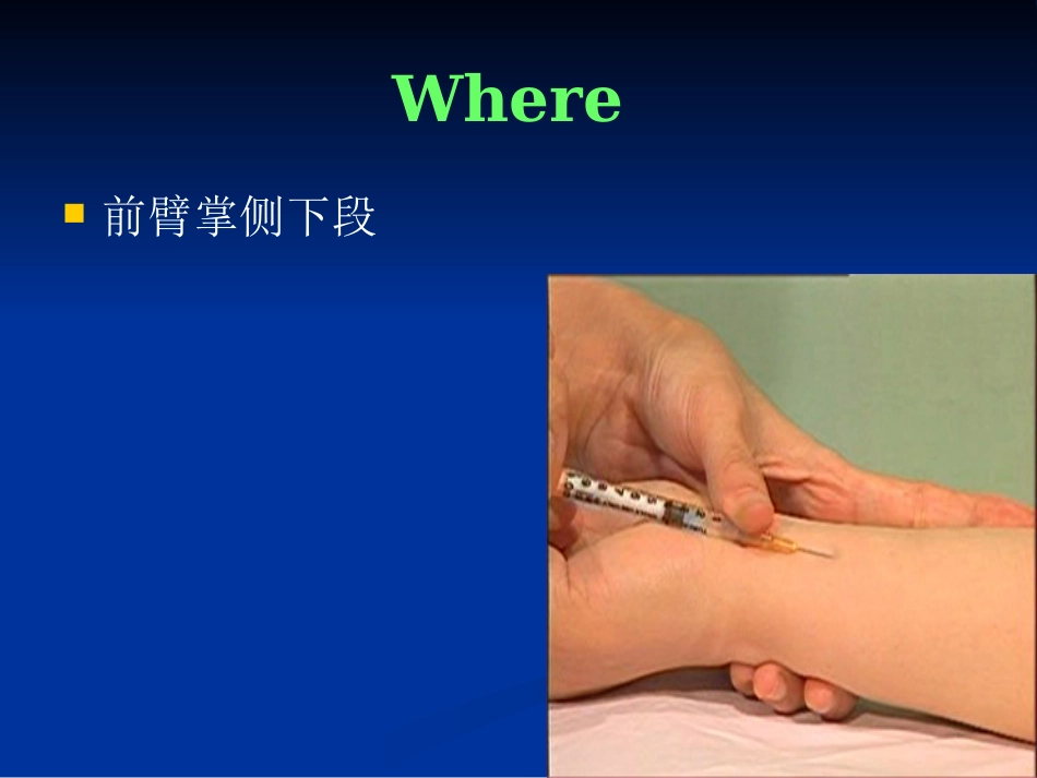 《药物过敏试验》PPT课件_第13页