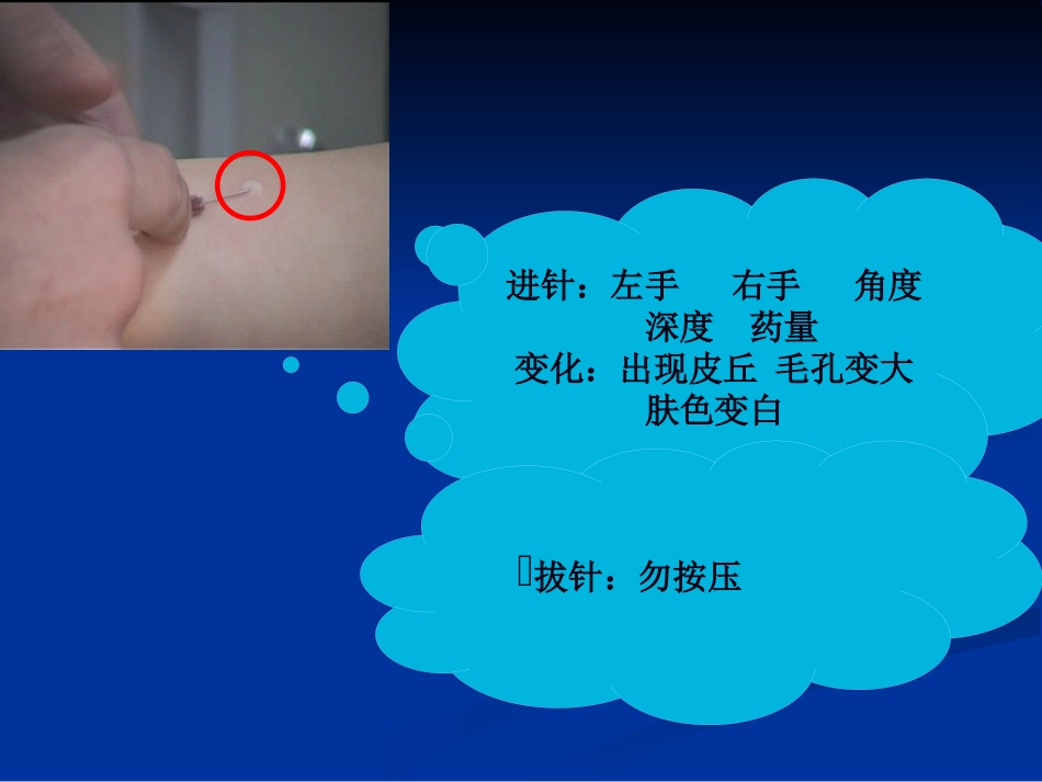 《药物过敏试验》PPT课件_第6页