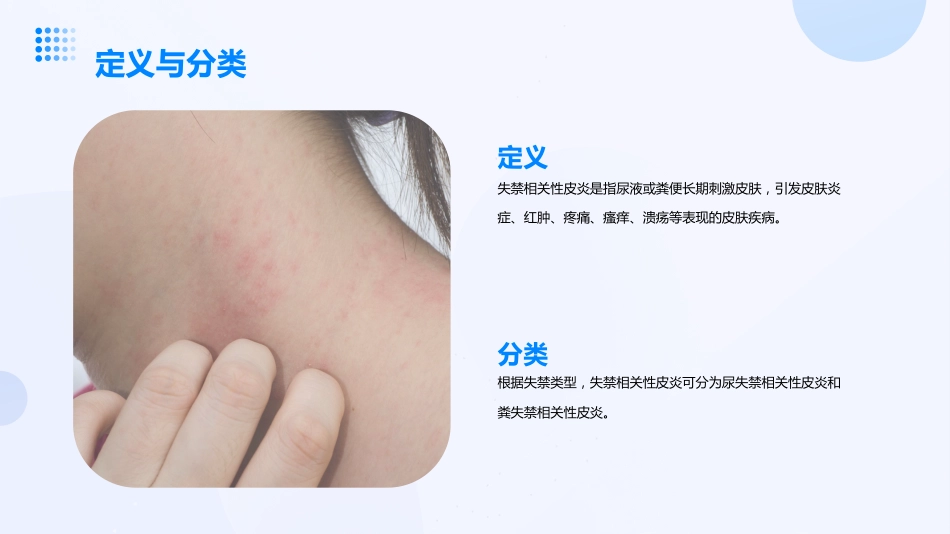 成人失禁相关性皮炎预防与护理ppt课件_1_第4页