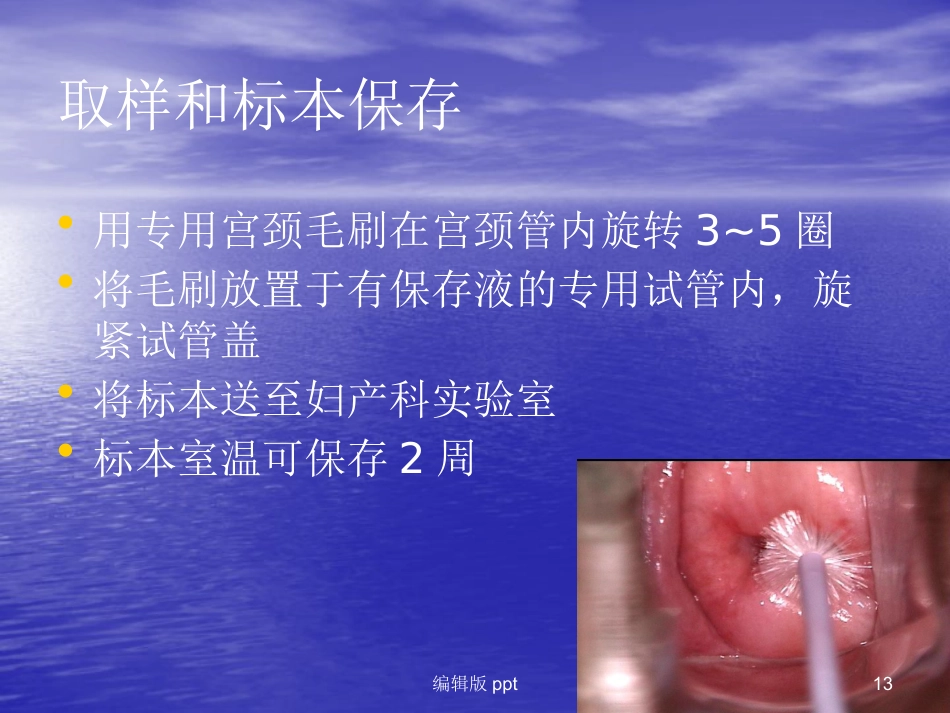 HPV-HC2用于宫颈癌筛查【18页】_第13页