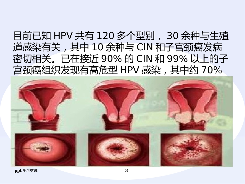 宫颈癌疫苗与HPVppt课件【18页】_第3页