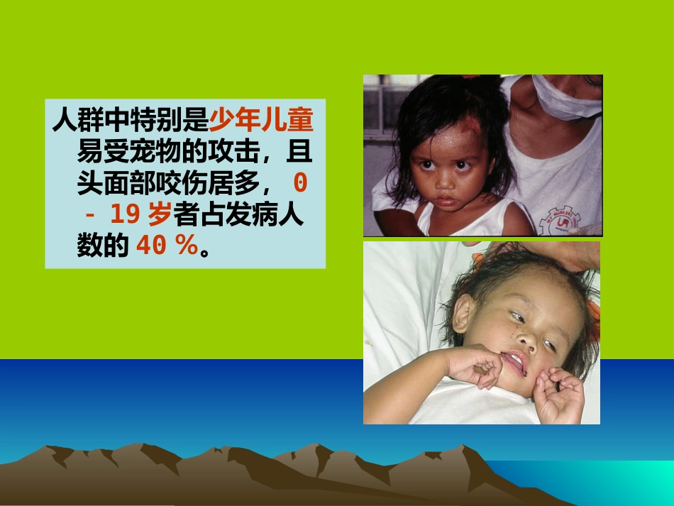 狂犬病病毒【18页】_第4页