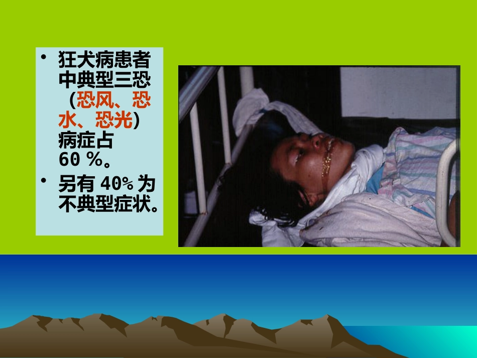狂犬病病毒【18页】_第5页