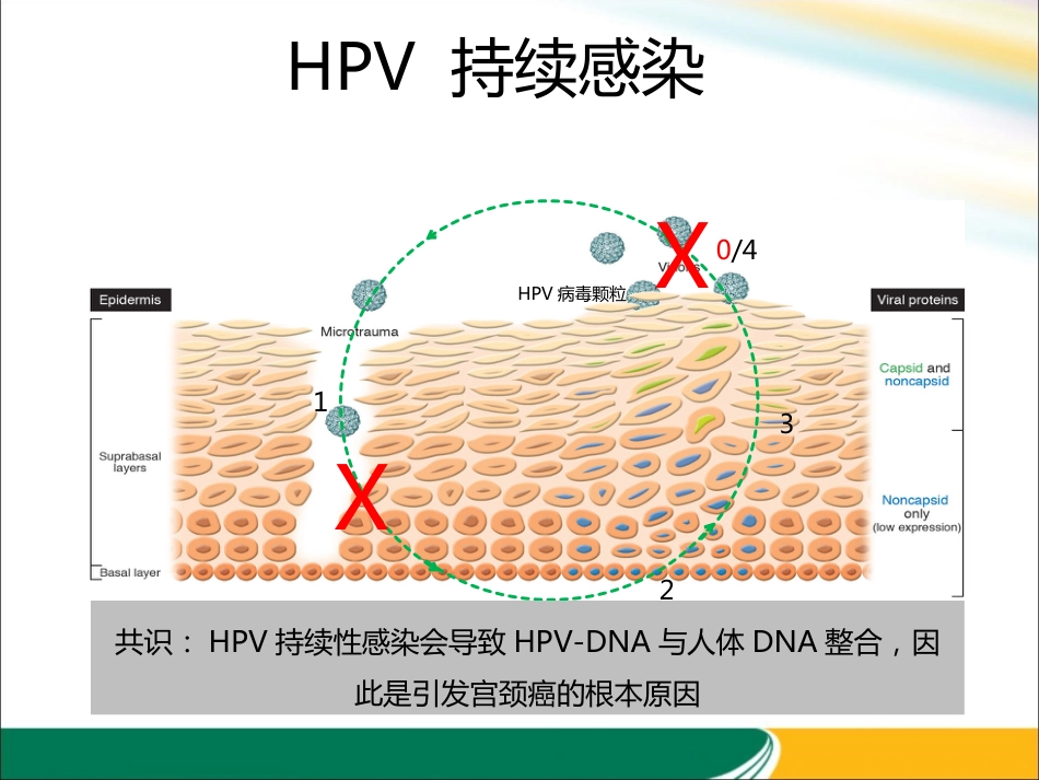 HPV与宫颈癌的关系x【21页】_第12页