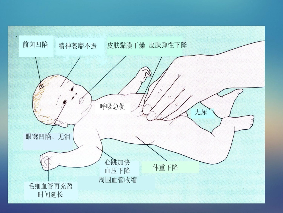 儿科轮状病毒肠炎【21页】_第15页