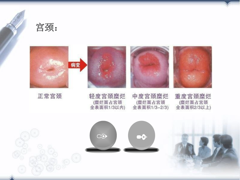 宫颈癌前病变概述(HPV)【32页】_第4页