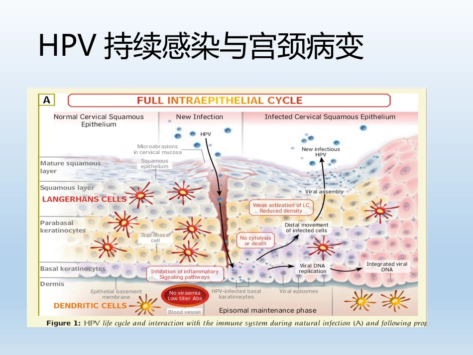HPV检测及临床应用【33页】_第10页