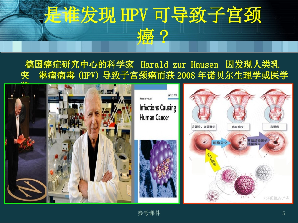 HPV感染与宫颈癌关系【34页】_第5页