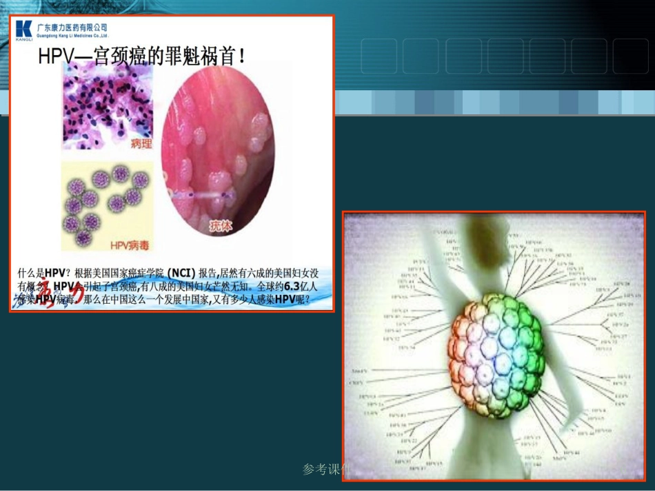 HPV感染与宫颈癌关系【34页】_第6页