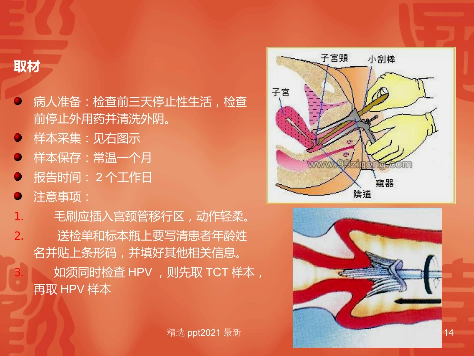 TCT和HPV检测在宫颈癌诊断中的临床应用【34页】_第14页