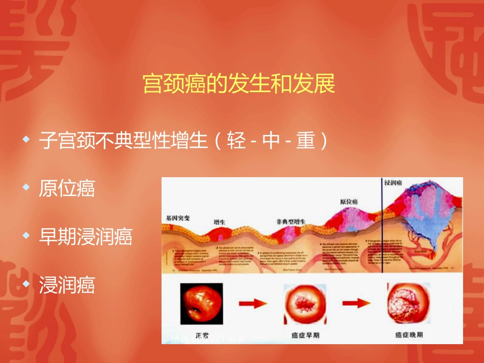 TCT和HPV检测在宫颈癌诊断中的临床应用【34页】_第5页