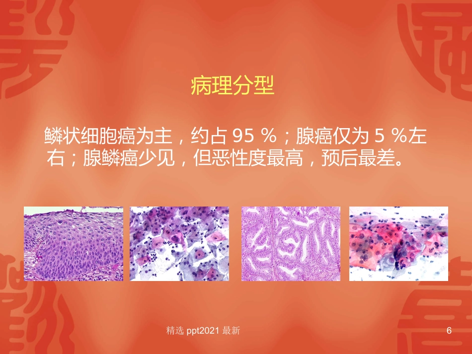 TCT和HPV检测在宫颈癌诊断中的临床应用【34页】_第6页
