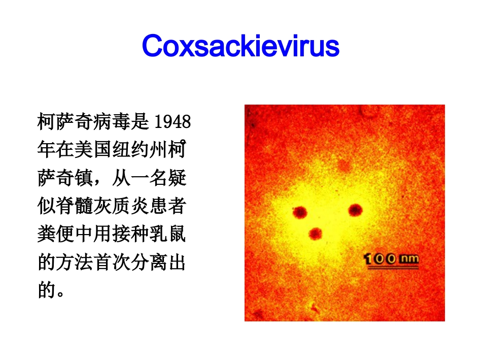 肠道病毒和轮状病毒标准版PPT【41页】_第3页
