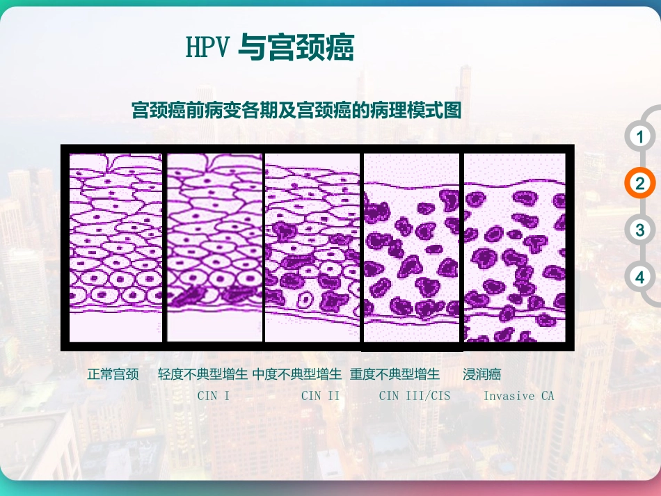HPV DNA分型与临床 PPT【51页】_第15页