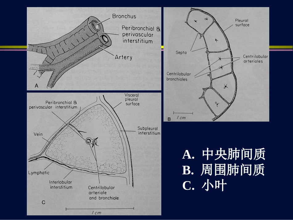 肺孢子虫肺炎与巨细胞病毒肺炎【116页】_第6页