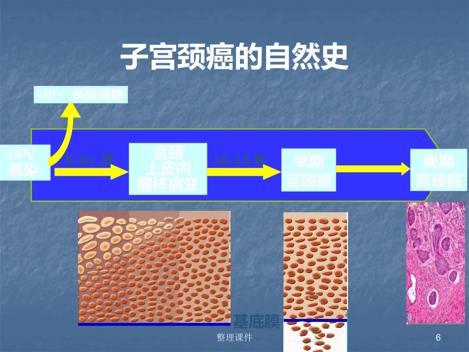 HPV感染与宫颈病变的规范化处理【122页】_第6页