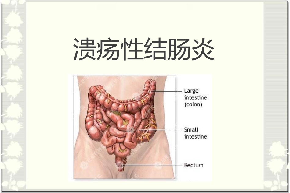 消化内科-溃疡性结肠炎_第1页