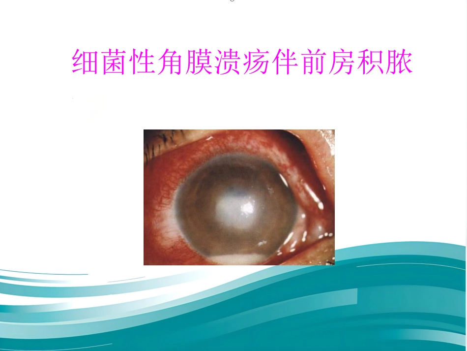 角膜病课件_第13页