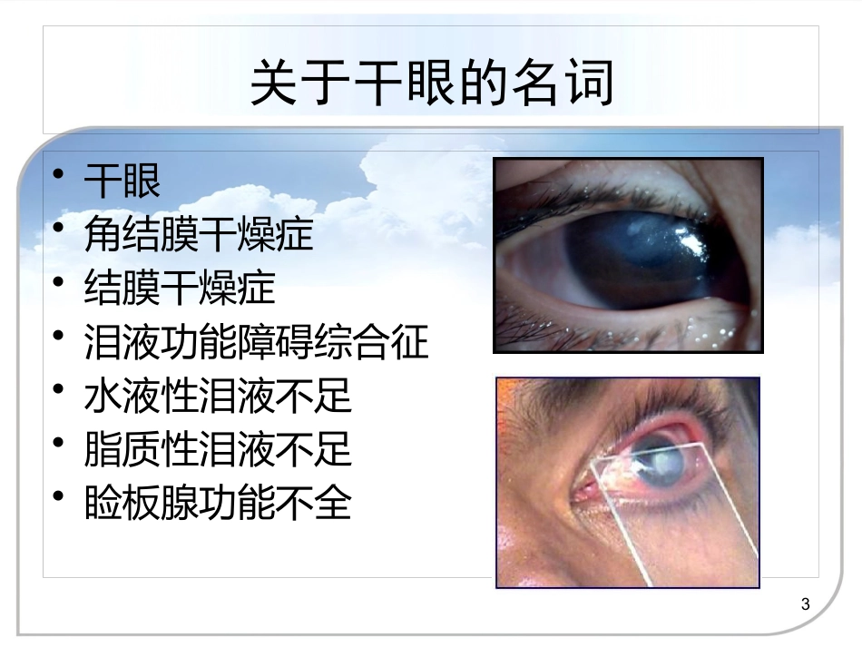 干眼症的诊治方案_第3页