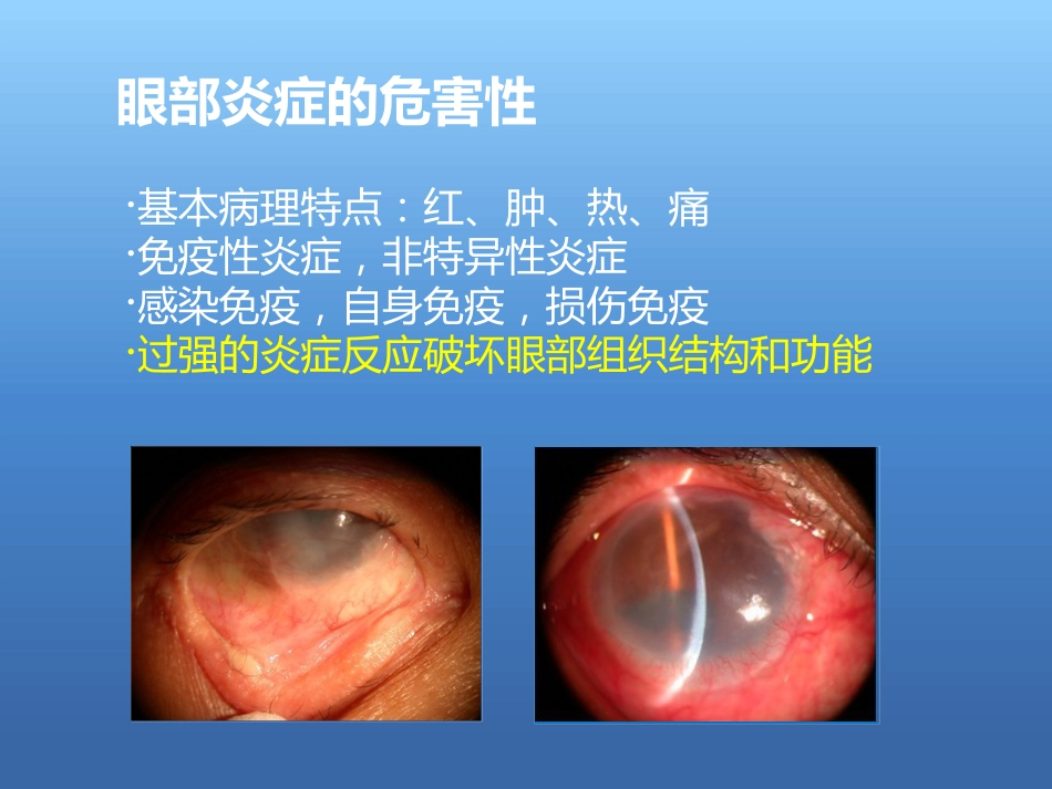 激素在眼表疾病中的使用原则与策略_第2页