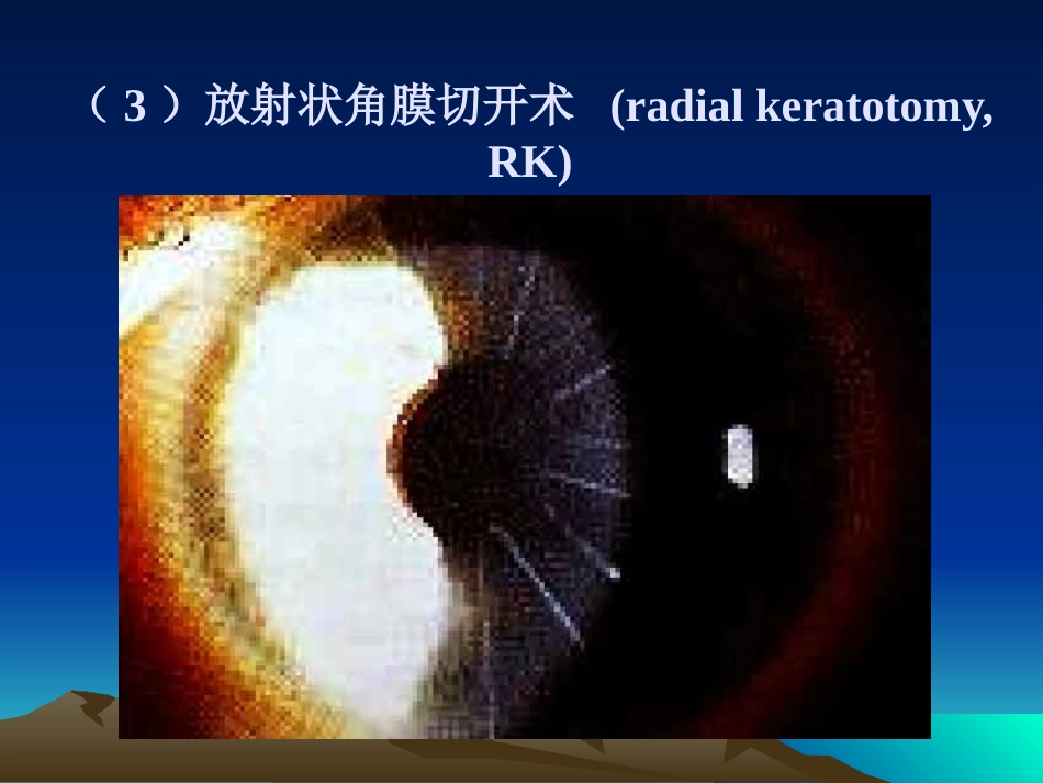 角膜病_第7页