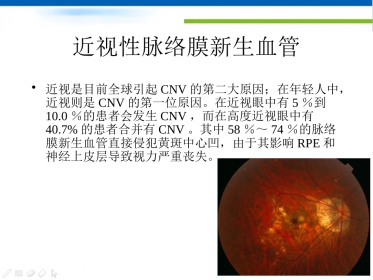 高度近视黄斑新生血管改汇总