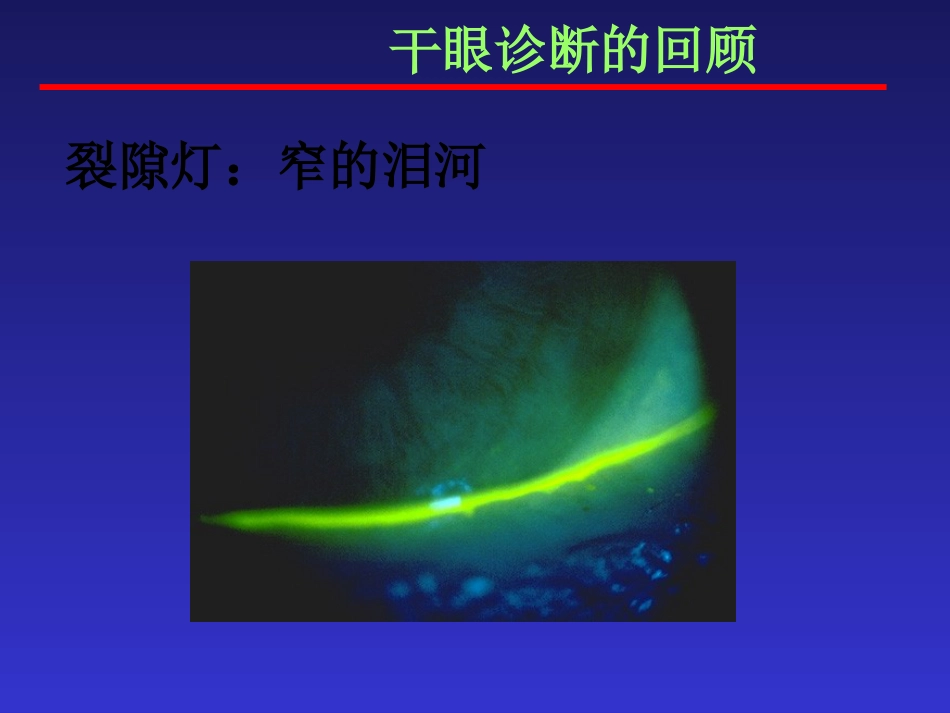 干眼症的防治_第14页
