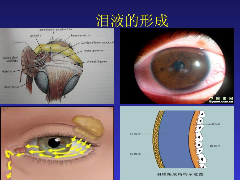 干眼症的防治_第3页